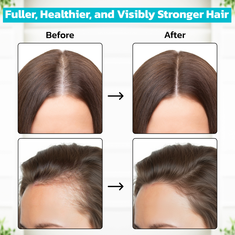 Minoxidil 2% (60ml)